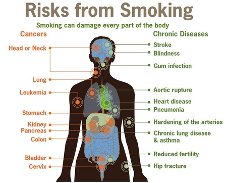 Hút thuốc ảnh hưởng trầm trọng đến sức khỏe tổng thể của con người - Minh họa: Internet