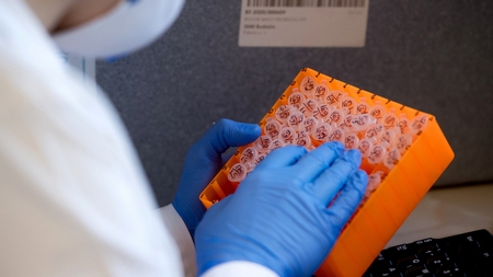 Các mẫu Coronavirus tại phòng thí nghiệm lớn nhất chuyên về dịch tễ học của Hungary thuộc Trung tâm Y tế Công cộng Quốc gia, ngày 3-4-2020 - Ảnh: Koszticsák Szilárd (MTI)